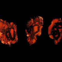 DEATHSPELL OMEGA - Kénôse LP